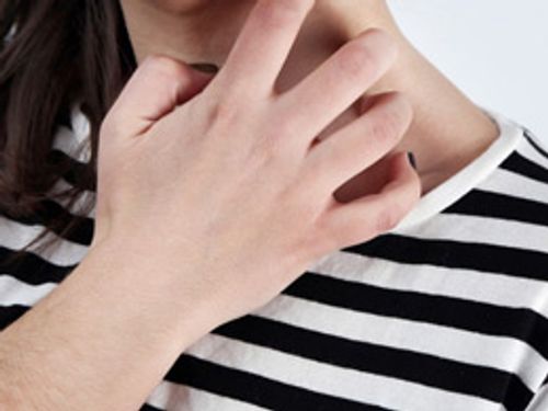 湿疹用什么药治疗