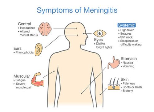 Symptoms of Meningitis patient. Diagram to showing signs of disease.