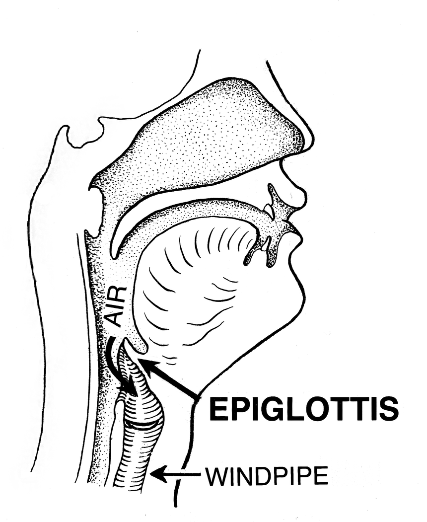 epiglottis psf