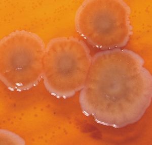 Pseudomonas aeruginosa