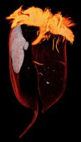 Hunting the Hydrogenobody: Why the Newest Microscopic Discovery is a Climate Breakthrough