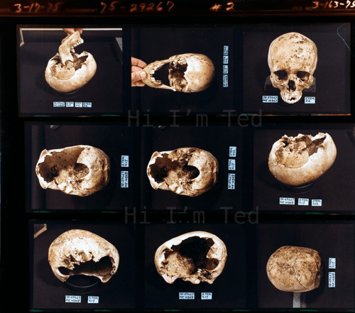 Taylor Mountain Ted Bundy crime scene Washington 1975 skull