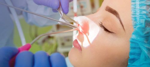 ENT Procedure
