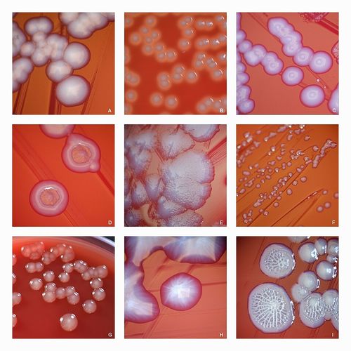 escherichia coli colonies