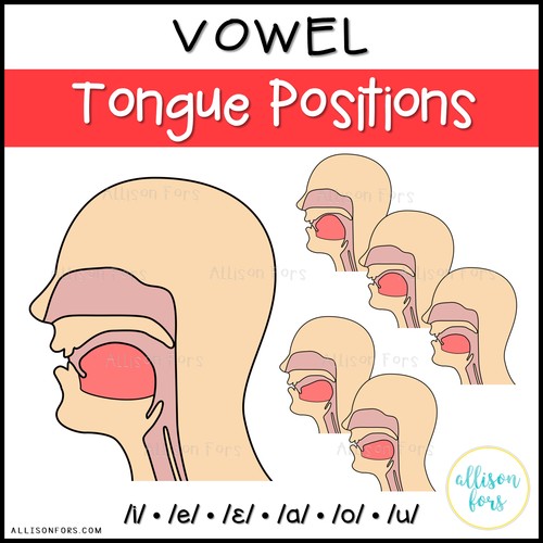 Proper Tongue Posture Diagram