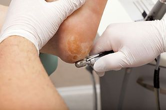 Full foot treatment service