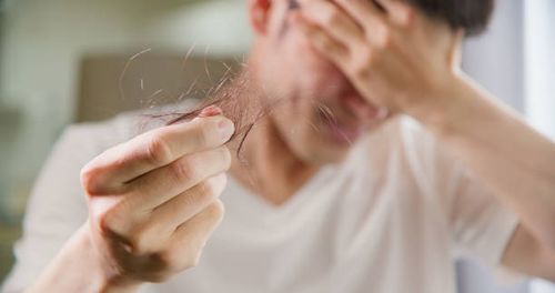 Hairloss