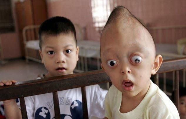 Orphans of Agent Orange: 50 years on children suffer from effects of U.S chemical weapons in ...