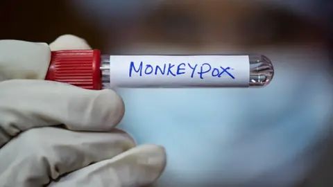 Getty Images A medical professional holds a test tube labelled monkeypox