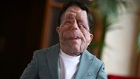 Adam Pearson knows he's 'A Different Man.' He wants to talk about it.