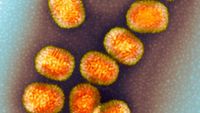 This Virus Stole a Human Gene and Won’t Let Go of It - The New York Times