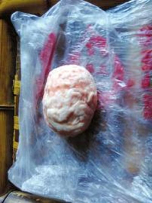 乐山市民李金焱从猪胃里取出来的怪蛋。