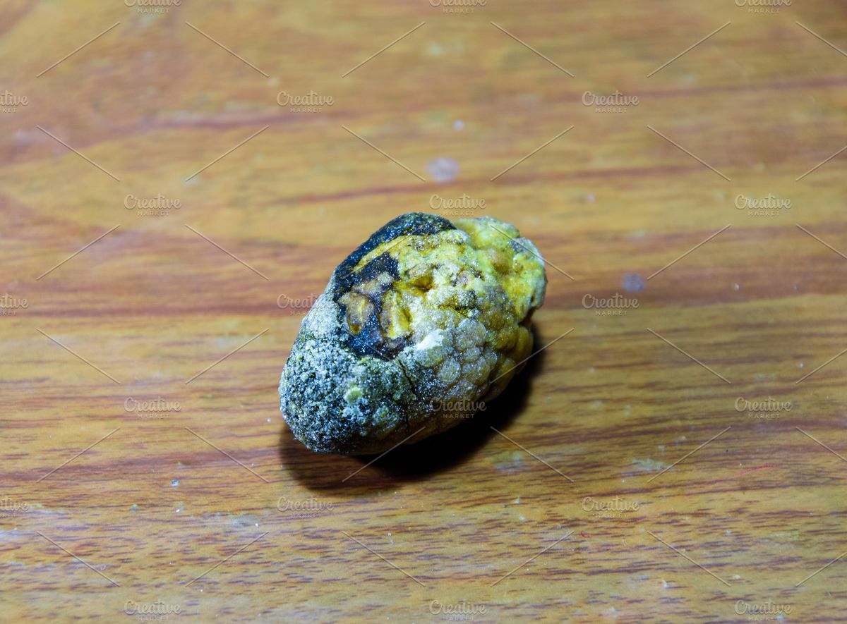 गॉल ब्लैडर स्टोन के मरीजों को रखना चाहिए खान पान का विशेष ध्यान