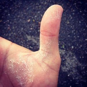When The Bass Gets More Than Just Your Thumb, You Can Call It &Quot;Bass Hand.&Quot; Photo By Michele Eichstead