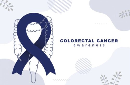 colon cancer 1920px 571310429 1013x665