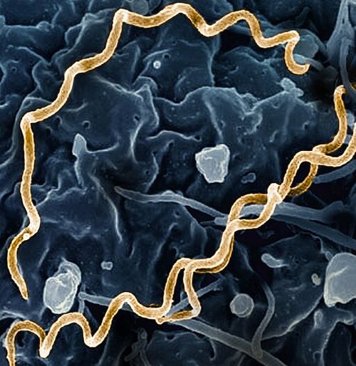 Treponema_pallidum_Bacteria_(Syphilis)_(cropped).jpg