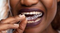 Byte Aligners Review 2024: Costs & Benefits – Forbes Health