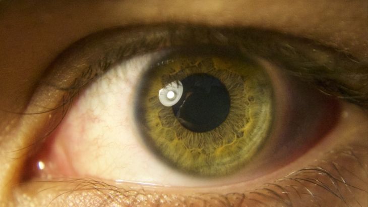 اكتشفت الخلايا العصبية الحساسة للضوء في شبكية العين قبل عقد من الزمان (بيكساباي)