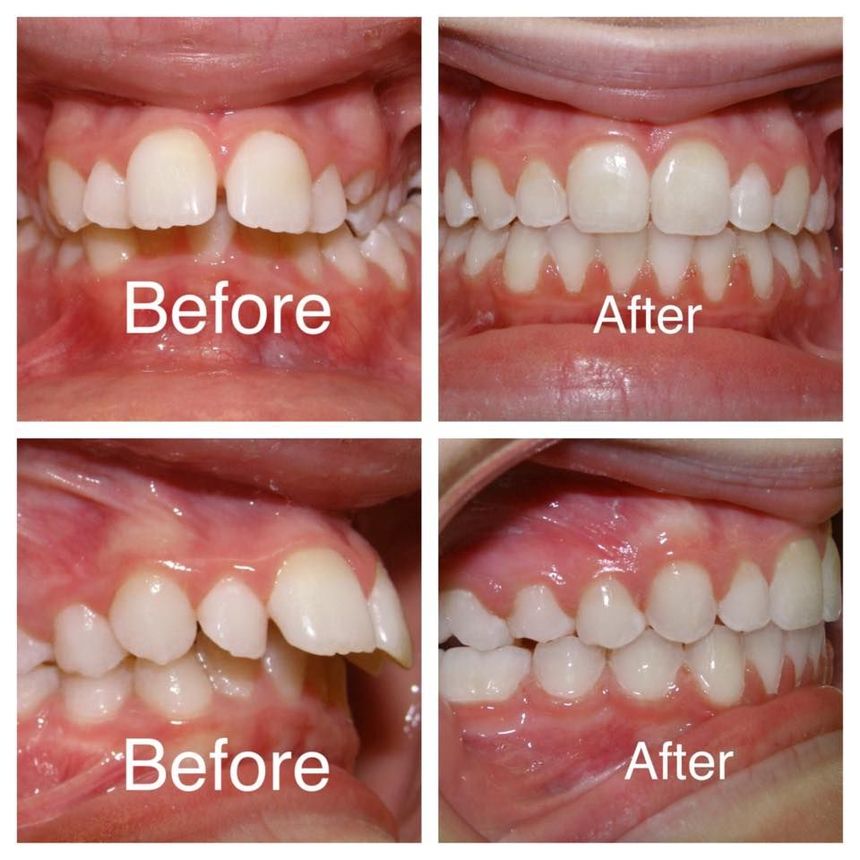 orthodontics