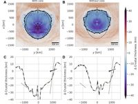 The Lunar Mantle Gold Rush: Why the South Pole-Aitken Basin is the Ultimate Scientific Jackpot