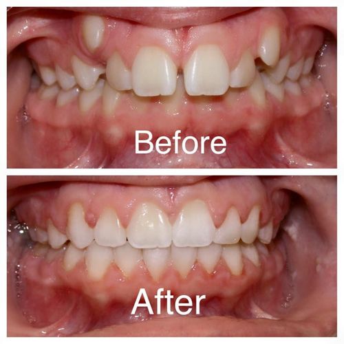 orthodontics