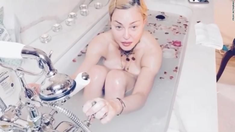 How Much Plastic Surgery Do You Reckon Madonna Has Had?