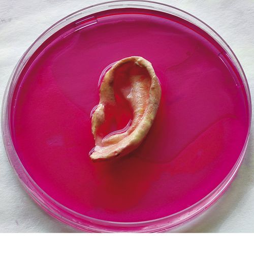 Bioimpresión 3D: ¿El fin de las listas de espera para trasplantes?