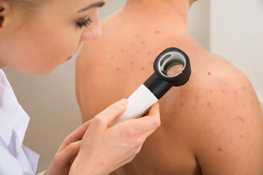Parfois, l'identification d'un cancer de la peau potentiel n'est pas si simple. Le cancer de la peau se présente sous de nombreuses formes et les tumeurs ne présentent pas toujours les caractéristiques les plus connues de la maladie.