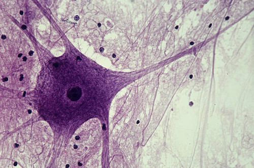neuron (motor), spinal cord, 100x at 35mm. shows: cell body, nucleus, dendrites (several), axon (single, long nerve fiber), and neuroglial cells (black spots). - pns stock pictures, royalty-free photos & images