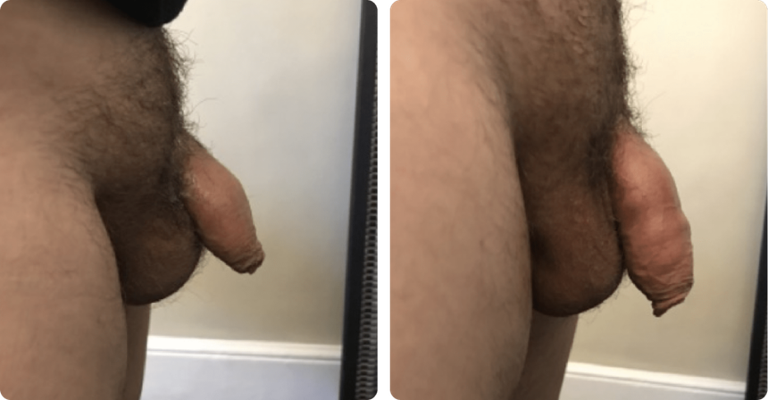 Improvement Result