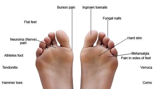 foot conditions that affect the aged
