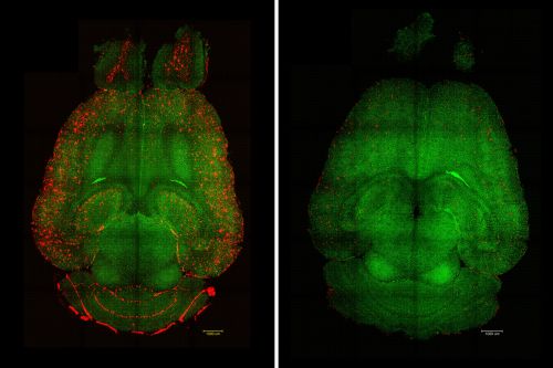 Blog. Nanobots que reparan neuronas: el amanecer de los tratamientos para el Alzheimer y el Parkinson