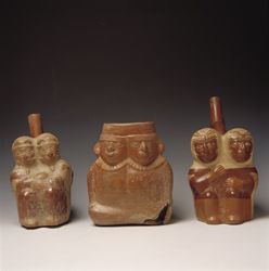 conjoinedtwinslarcomuseum