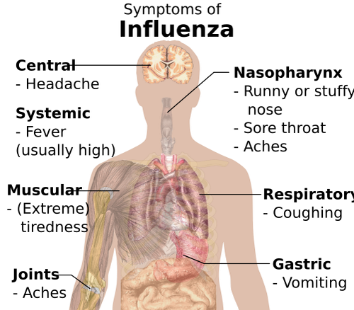 symptoms of influenza