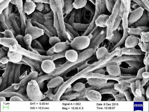 Candida albicans - Wikipedia