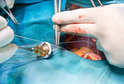ENT Procedure