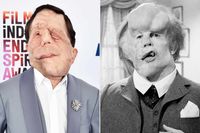 'A Different Man' Star Adam Pearson to Lead New Take on 'The Elephant Man' Movie: 'Beyond Honored'