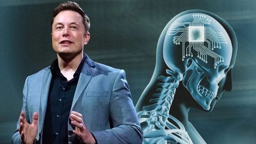 Is-Elon-Musks-Neuralink