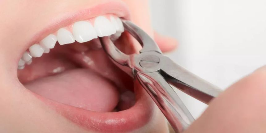 Совети пред и по екстракција на заб