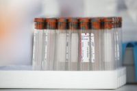 Becton Dickinson (BDX) Plans Life Sciences Segment Separation - Bloomberg