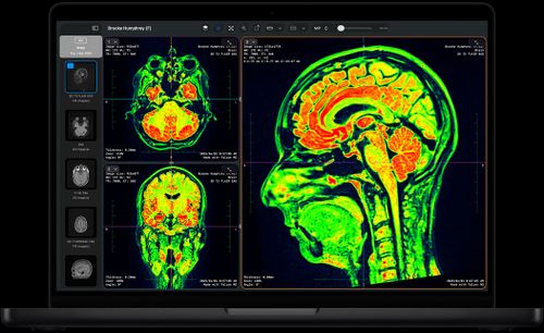 Screen of MacBook Pro showing Falcon MD