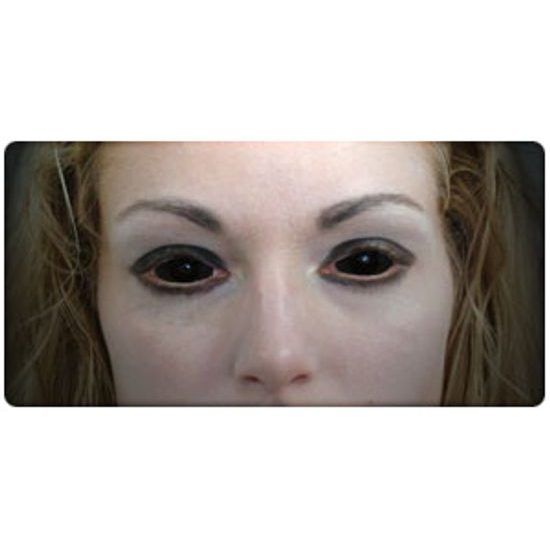 BLACK SCLERA Coloured Contact Lenses
