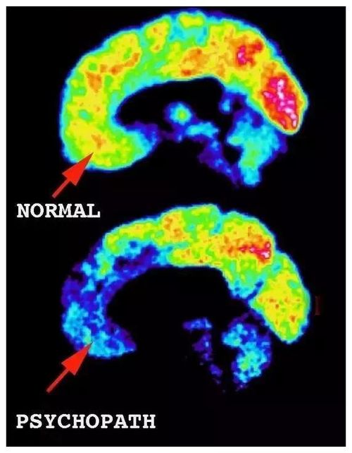 我们都会被环境“逼疯”？心理专家：每个人都有黑暗人格