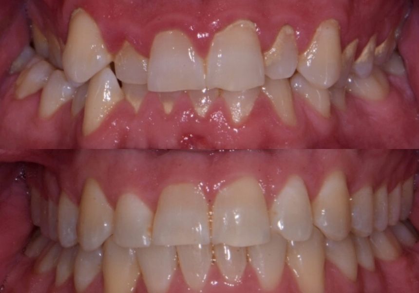 orthodontics