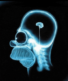 an x-ray of homer simpson 's head with a brain in it
